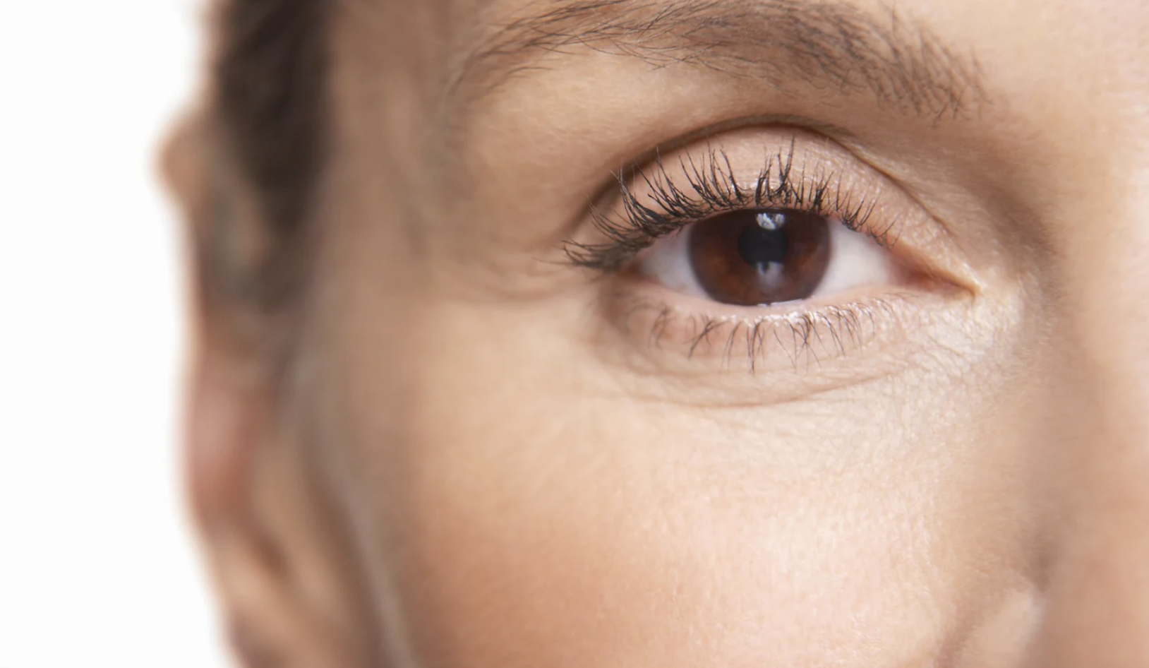 Eye Lift
